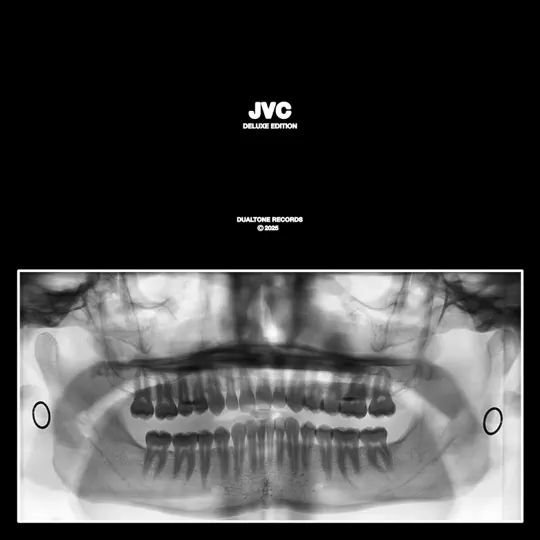 jvc